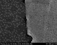 Prunus_laurocerasus_abaxial_overview_24_weeks_CHCl3.jpg